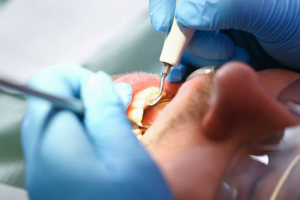 Best Teeth Whitening  in Campbellsport, WI