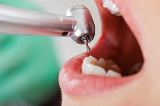 Best Root Canal Emergency Dentist  in Campbellsport, WI